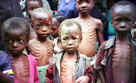 18,000 children malnurished in Kaduna