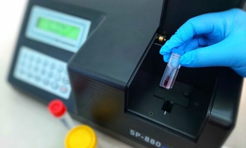 A New Paradigm: AptameX, A Synthetic, Saliva-Based Rapid Covid-19 Diagnostic Test with Sensitivity at CT Scores >25