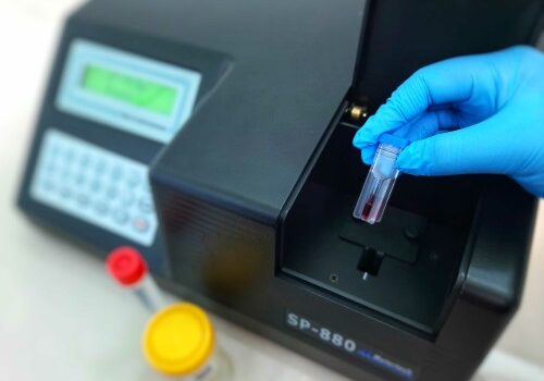 A New Paradigm: AptameX, A Synthetic, Saliva-Based Rapid Covid-19 Diagnostic Test with Sensitivity at CT Scores >25
