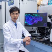 Hong Kong Baptist University joint research suggests that urine cytomegalovirus test facilitates early prediction of AIDS end-organ diseases