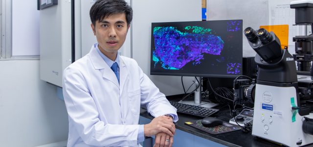 Hong Kong Baptist University joint research suggests that urine cytomegalovirus test facilitates early prediction of AIDS end-organ diseases