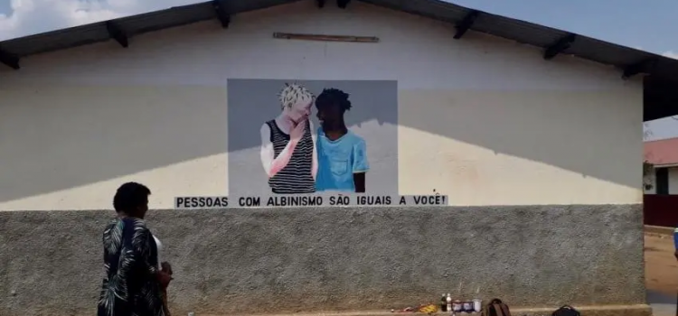 Breaking Educational Barriers for Children with Albinism