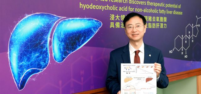 HKBU-led research discovers therapeutic potential of hyodeoxycholic acid for non-alcoholic fatty liver disease
