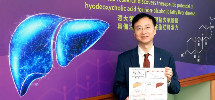 HKBU-led research discovers therapeutic potential of hyodeoxycholic acid for non-alcoholic fatty liver disease