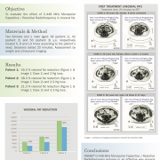 Case Study Highlights INDIBA 448 kHz Radiofrequency’s Role in Visceral Fat Reduction and Prevention of Fat Accumulation